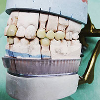 Mec�nica Dental